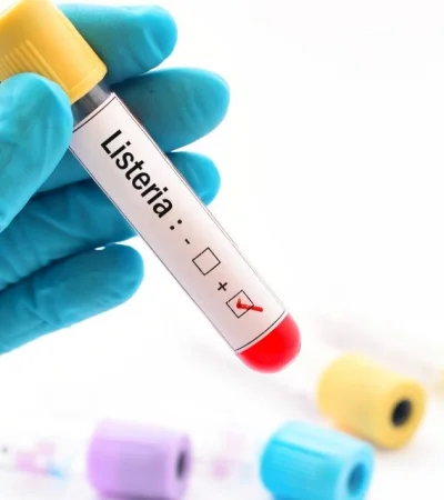 Alerta nacional: brote de listeriosis mortal por queso contaminado