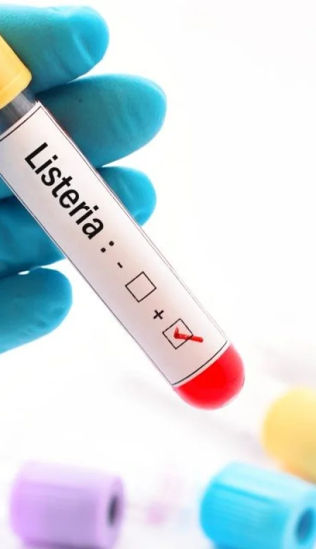 Alerta nacional: brote de listeriosis mortal por queso contaminado