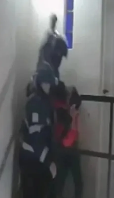 Joven golpeado por la policía de Santa Cruz.