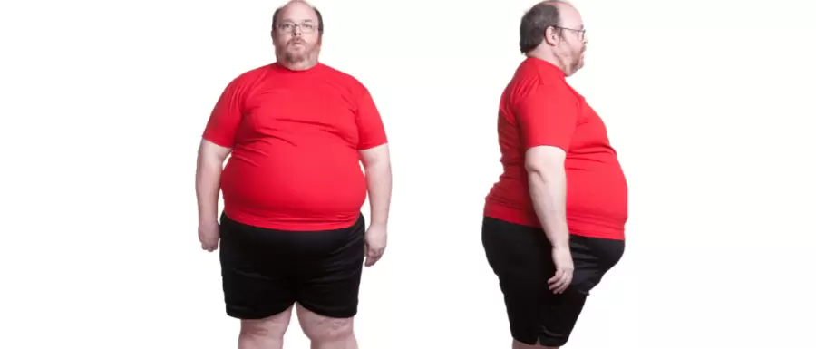 Las personas con obesidad tienen más problemas para aprender nuevas tareas o recordar cosas, ya que tienen afectada la plasticidad cerebral.