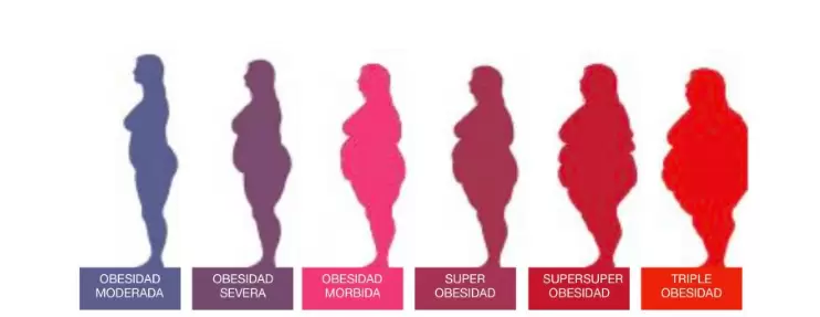 La obesidad se mide mediante el índice de masa corporal, o IMC, cuya fórmula incluye el peso en kilogramos dividido por la talla en metros al cuadrado