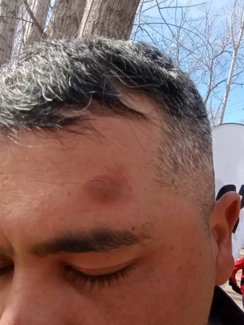 El guardia de seguridad habría terminado lesionado: Fuente: Desert