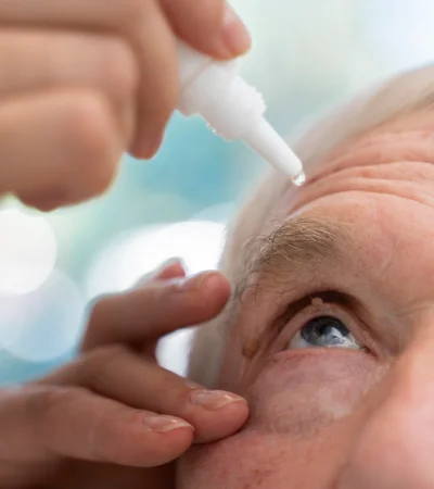 Las gotas permite corregir la presbicia sin lentes ni cirugía, con efecto rápido y temporario.