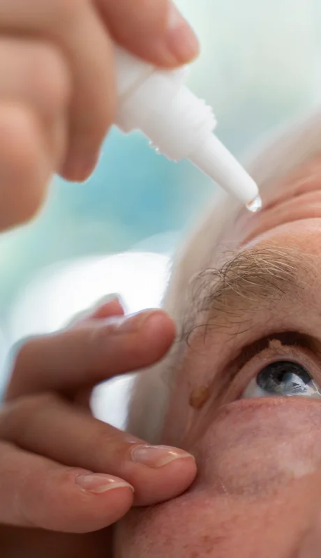 Las gotas permite corregir la presbicia sin lentes ni cirugía, con efecto rápido y temporario.