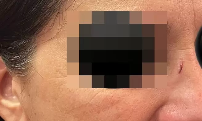 La directora fue agredida por una alumna y su madre.