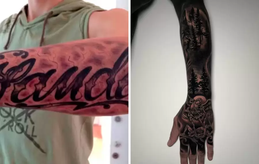 El impactante antes y después del brazo de Mauro Icardi tras borrar los tatuajes de Wanda Nara.