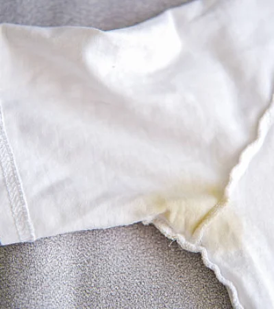 Truco para quitar las manchas amarillas de la ropa blanca.