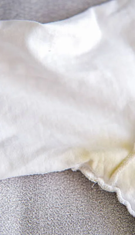 Truco para quitar las manchas amarillas de la ropa blanca.