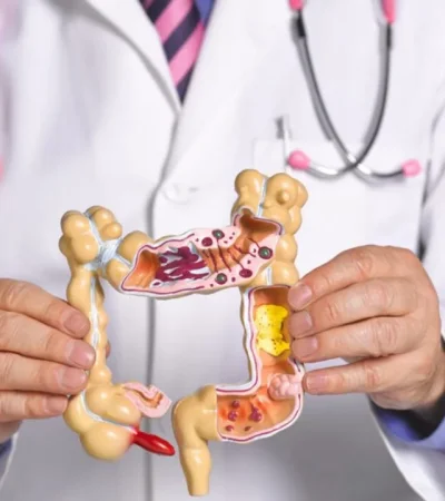 Cáncer colorrectal