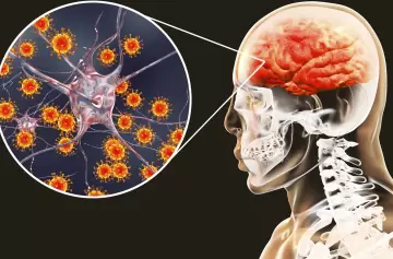 Día Mundial de la Meningitis: prevenirla es clave para salvar vidas