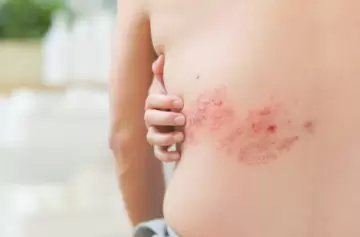 La enfermedad que atacó a Palito Ortega: el virus que todos tienen y que "despierta" con la edad