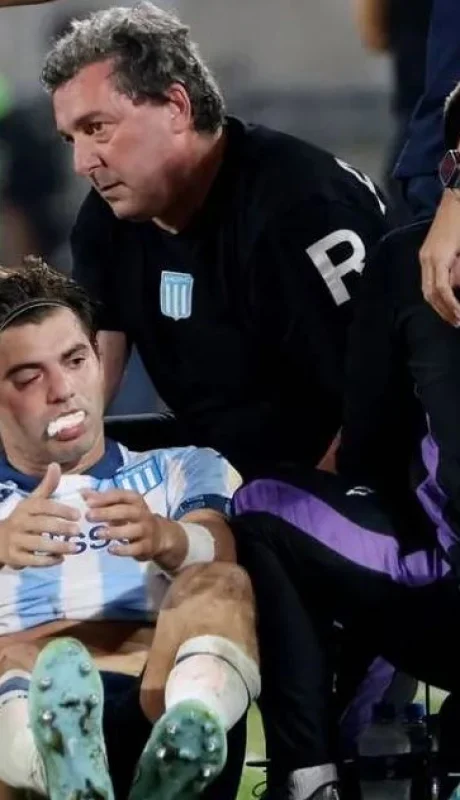 Santiago Sosa será operado y no jugará la semifinal de vuelta.