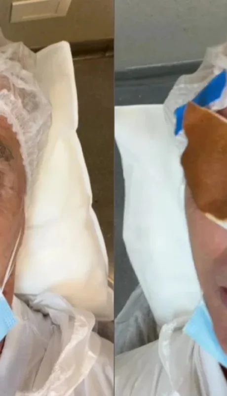 Marley posteó fotos y un video de su operación