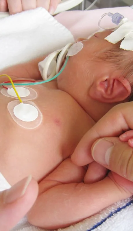 Pueden quedar secuelas de todo tipo, según lo que la mamá consuma. No se trata sólo de cocaína o marihuana.