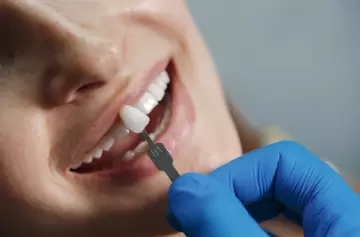 La muerte en un implante reabre el debate: ¿qué es realmente la estética dental?