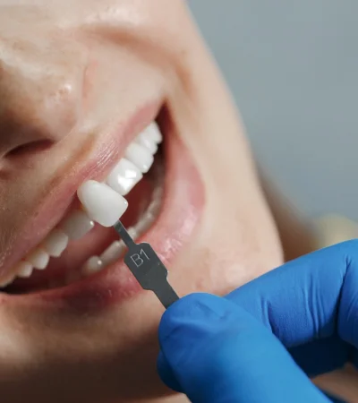 Estética dental: consejos de una especialista tras la muerte en una clínica porteña.