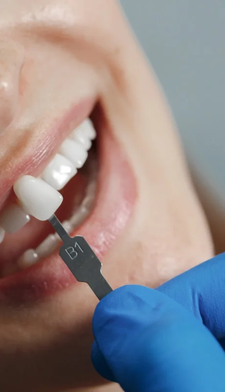 Estética dental: consejos de una especialista tras la muerte en una clínica porteña.