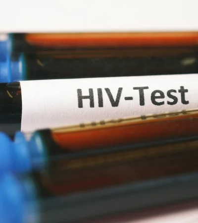 Todos los test de VIH son gratuitos, anónimos y se recomienda hacerlo cada año.