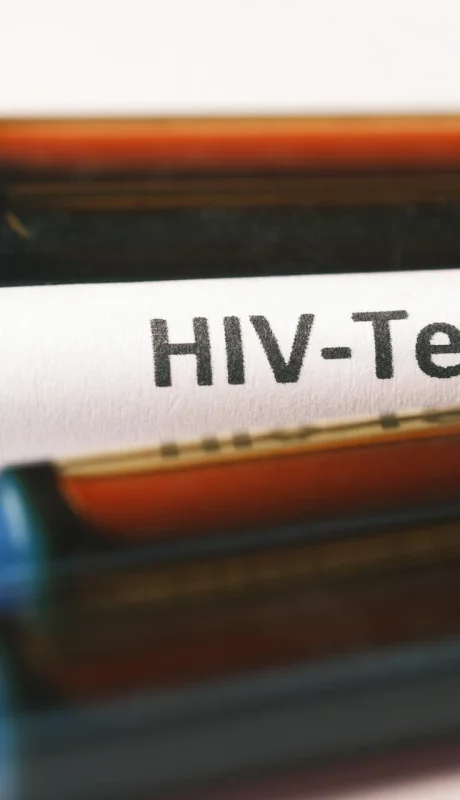 Todos los test de VIH son gratuitos, anónimos y se recomienda hacerlo cada año.