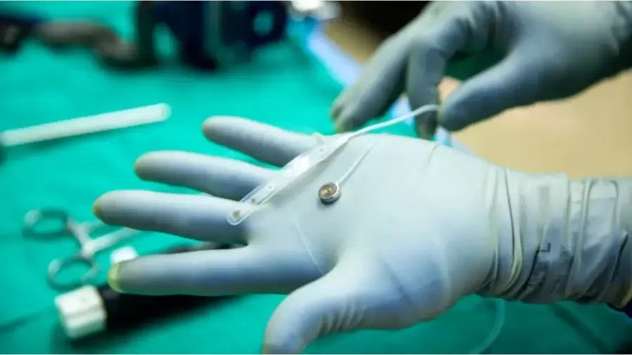 El dispositivo de Paradromcis es más pequeño que una moneda. Foto: web