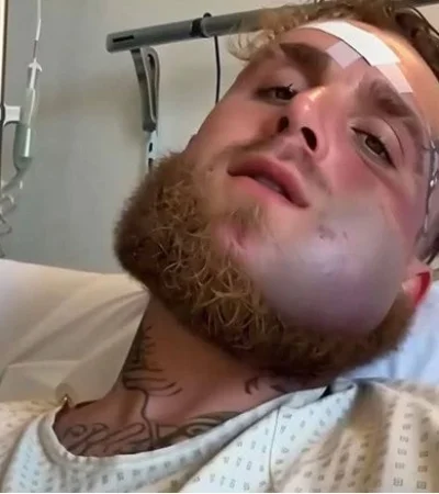 Así quedó el rostro del influencer