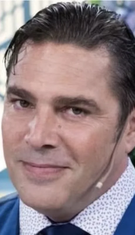 La foto de Matías Alé tras el incendio y su internación de urgencia.