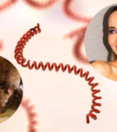 A diferencia de otros patógenos, la bacteria de la leptospirosis tiene una forma particular: un espiral o resorte.