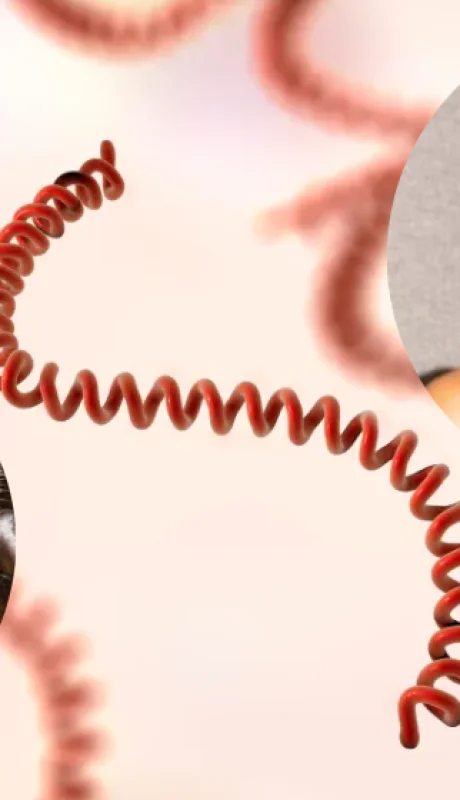 A diferencia de otros patógenos, la bacteria de la leptospirosis tiene una forma particular: un espiral o resorte.