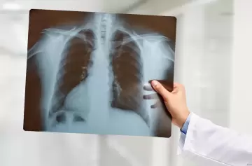 El hombre que vivió 48 horas sin pulmones: ¿el fin de las listas de espera?