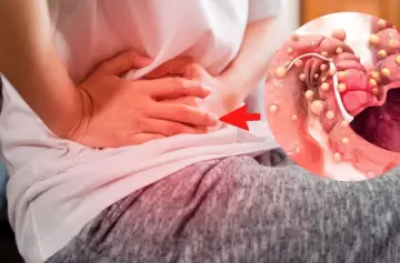 El cáncer de colon y una advertencia clave: el estudio sencillo que puede salvarte la vida