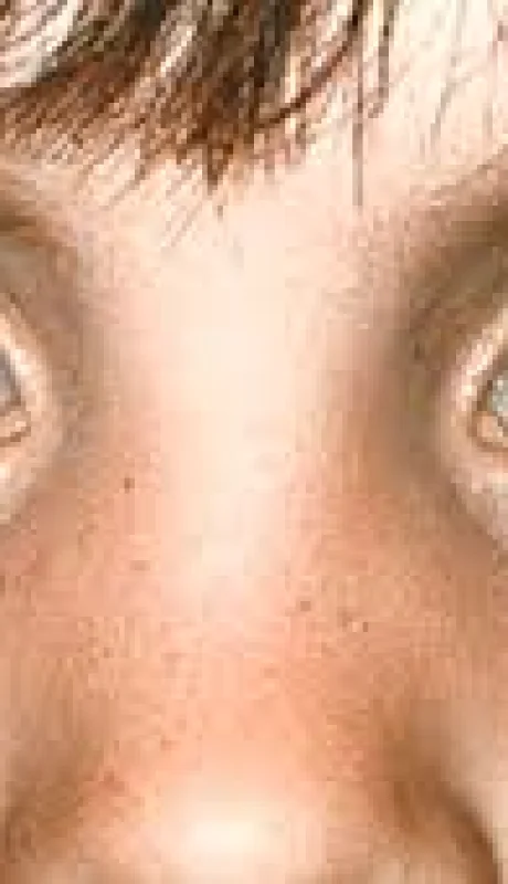 El flash de tu celular puede salvarle la vida: cómo detectar el cáncer ocular en niños con una foto.