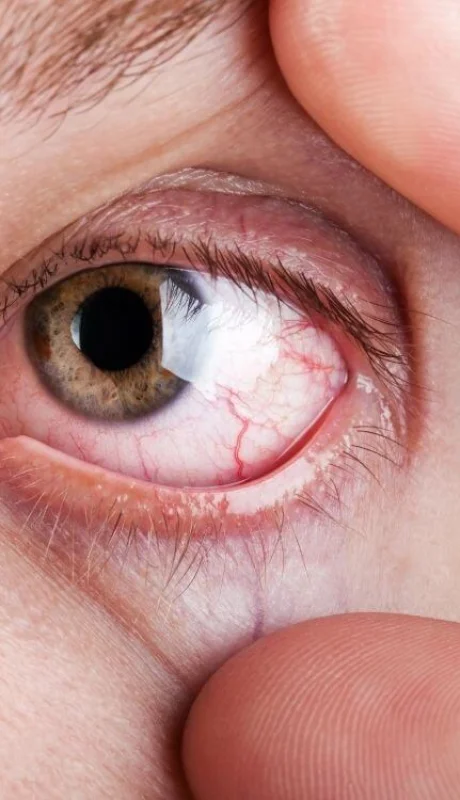 La trampa de la hiperconectividad: Pasamos más de 12 horas diarias frente a dispositivos, un hábito que está "envejeciendo" prematuramente la vista.