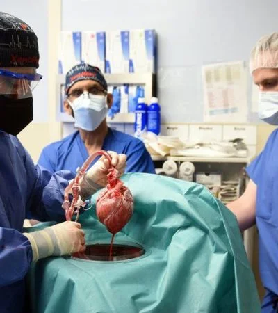 trasplanté de organo