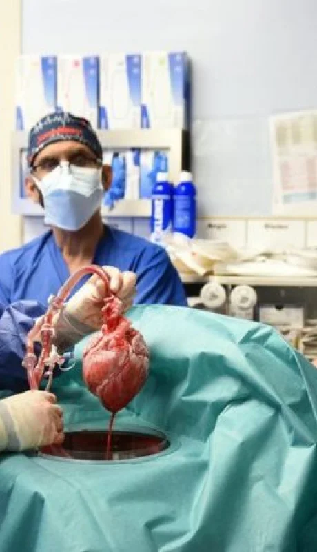 trasplanté de organo